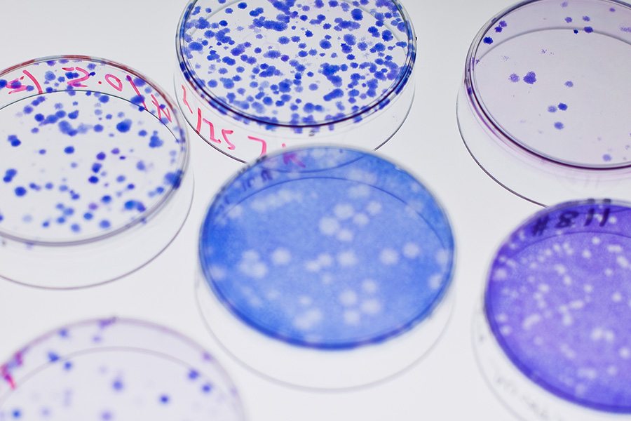 Cells in petri dish